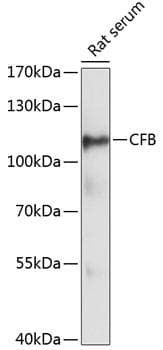 CFB / Complement Factor B Antibody