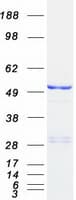 Human PDE7B Protein (Recombinant Myc-DDK (Flag))