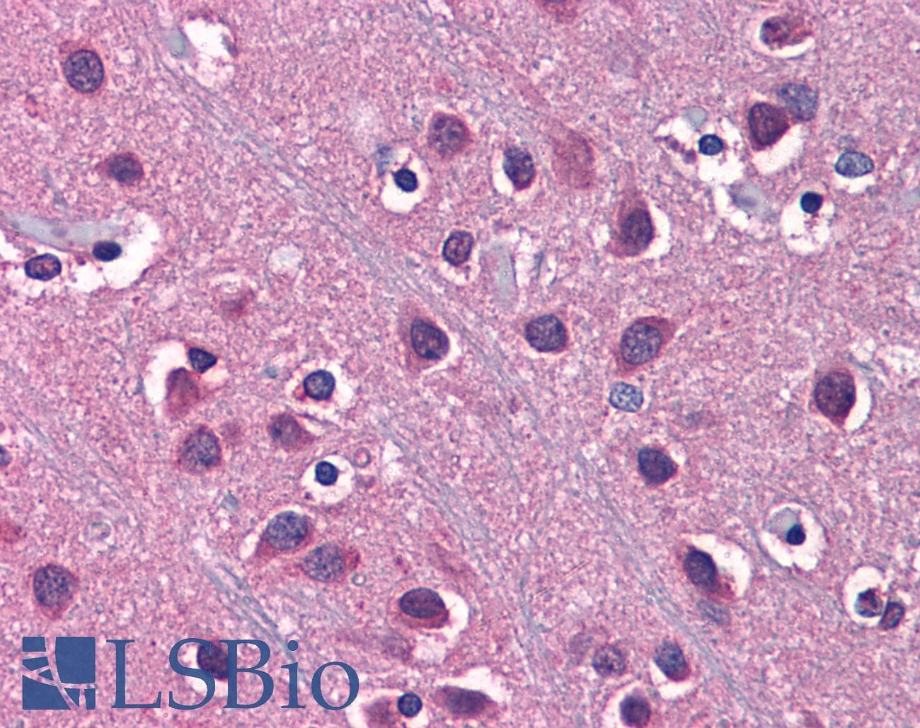 SLC1A2 / EAAT2 / GLT-1 Antibody (aa144-193)