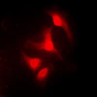 ABL1 / c-ABL Antibody (C-Terminus)
