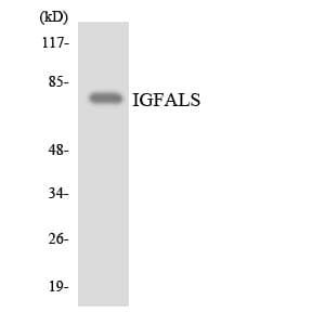 IGFALS / ALS Antibody (aa118-167)