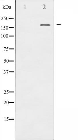 CML / BCR Antibody (phospho-Tyr177)