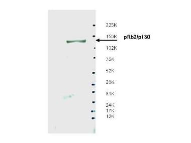 Polyclonal Rabbit anti-Human RBL2 / RB2 p130 Antibody (WB)