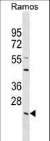 LYPLA2 Antibody (aa181-207)