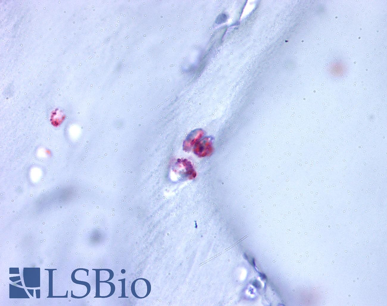 IHC-plus™ Polyclonal Rabbit anti-Human ACAN / Aggrecan Antibody (C-Terminus, IHC)