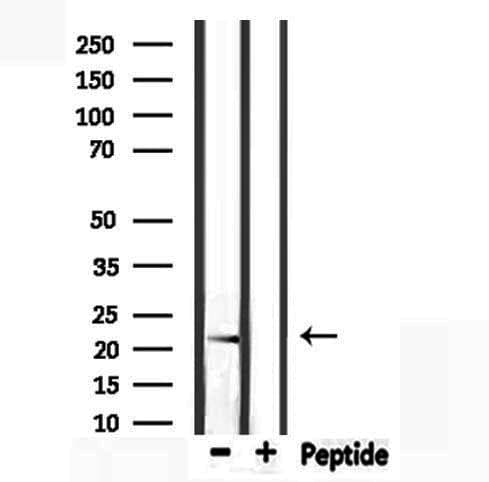 CYBA / p22phox Antibody