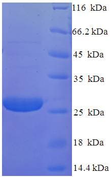 Human RS1 / Retinoschisin 1 Protein (Recombinant GST)