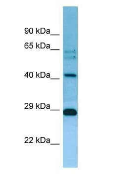 MRPL38 Antibody (C-Terminus)