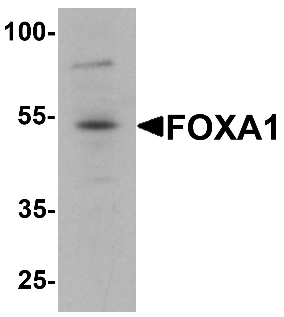 IHC-plus™ FOXA1 Antibody