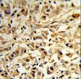 MAT2B Antibody (aa80-107)