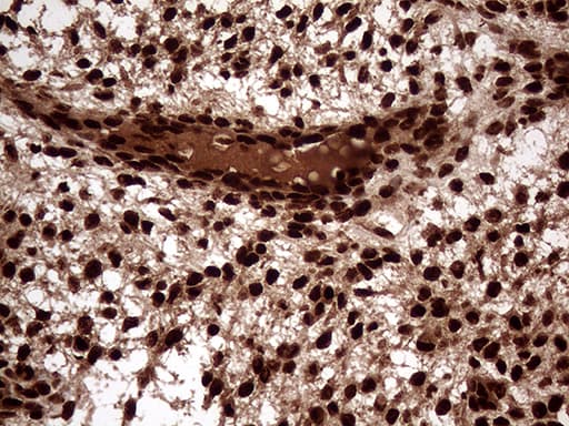 Monoclonal Mouse anti-Human TALDO1 / Transaldolase 1 Antibody (clone OTI1E5, IHC, WB)