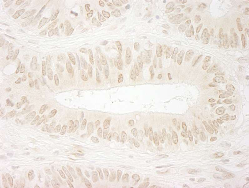 NABP2 Antibody (aa161-211)
