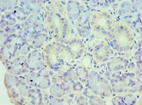Polyclonal Rabbit anti-Human HDAC8 Antibody (aa1-377, IHC, WB)