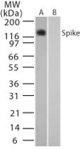 SARS-CoV Spike Glycoprotein Antibody (aa1124-1140)
