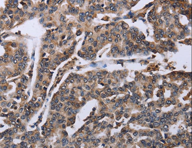 DDX11 / CHLR1 Antibody