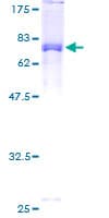 Human STK24 / MST3 Protein (Recombinant GST)