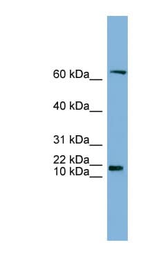 GM2A Antibody (N-Terminus)