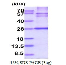 Human HLA-DRB1 Protein (Recombinant His)