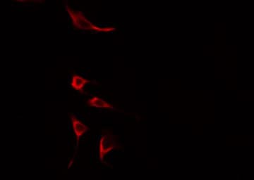 Polyclonal Rabbit anti-Human SNX4 Antibody (WB)