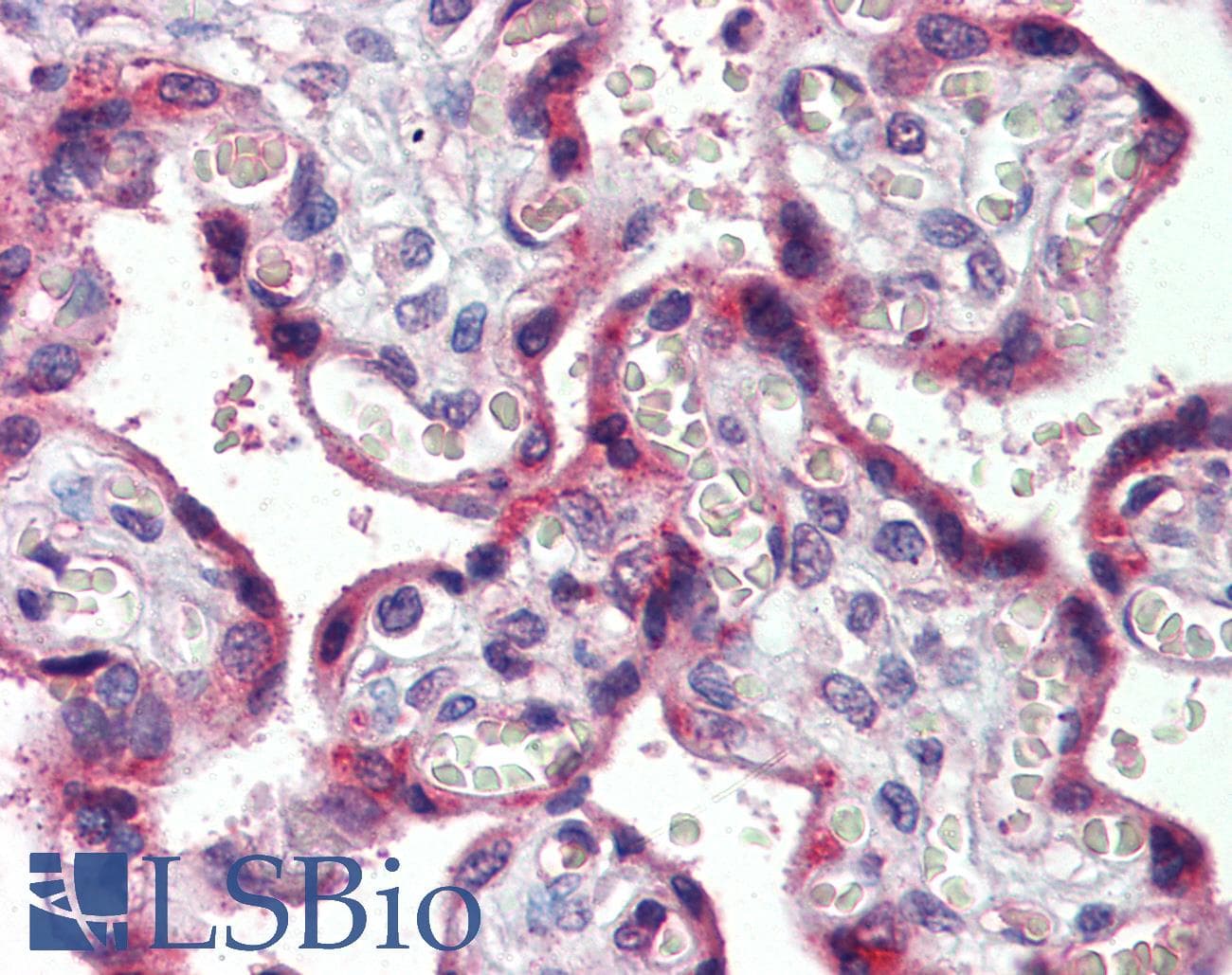 IHC-plus™ Polyclonal Goat anti-Human CCR4 Antibody (Extracellular Domain, IHC, WB)