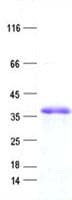 Human ZNF75A Protein (Recombinant His, N-Terminal)