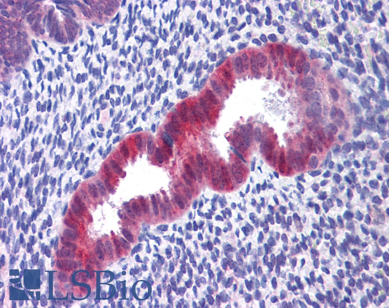 IHC-plus™ IDH1 / IDH Antibody