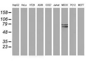 Monoclonal Mouse anti-Human BCHE / Cholinesterase Antibody (clone OTI1E1, WB)