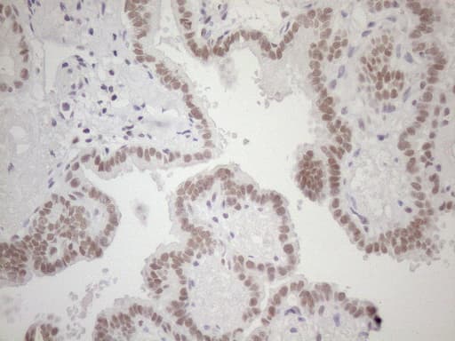 HSF2 Antibody (aa74-324, clone OTI3E1)
