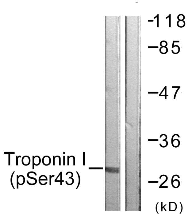 TNNI3 / Cardiac Troponin I Antibody (phospho-Ser43)
