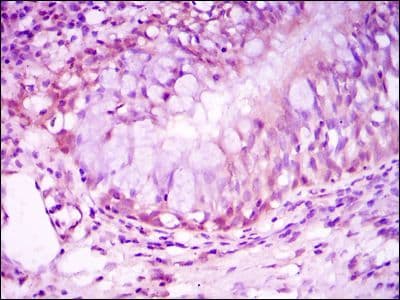 Monoclonal Mouse anti-Human NR3C1/Glucocorticoid Receptor Antibody (clone 6000000, IHC, IF, WB)