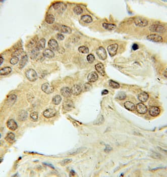 PRKAA1 / AMPK Alpha 1 Antibody