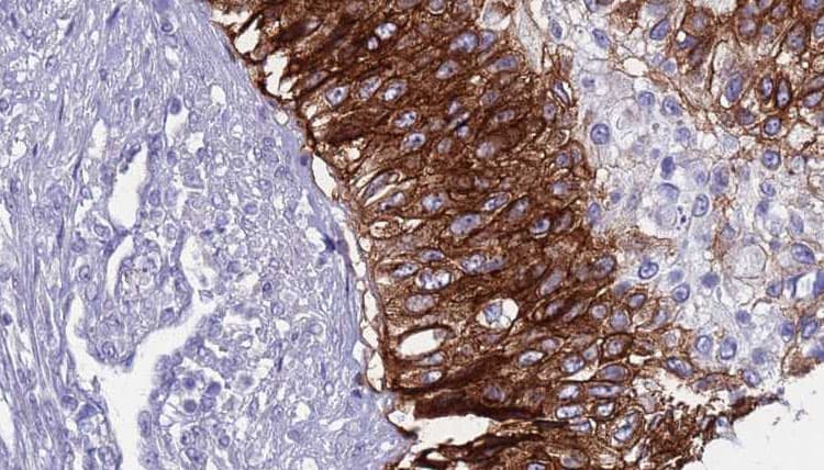 AQP5 / Aquaporin 5 Antibody