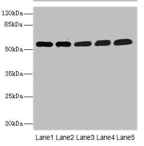 PALS2 / MPP6 Antibody