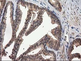 DSTN / Destrin Antibody (clone OTI2C10)