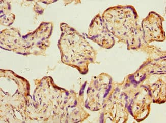 Polyclonal Rabbit anti-Human TIMM17A / TIM17 Antibody (IHC)