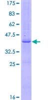 Human FGF5 Protein (Recombinant GST)