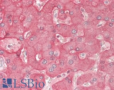 IHC-plus™ ASGR2 Antibody (aa106-286)