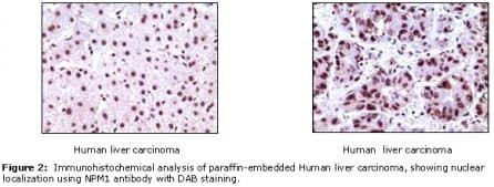 NPM1 / NPM / Nucleophosmin Antibody (clone 7H10B9)