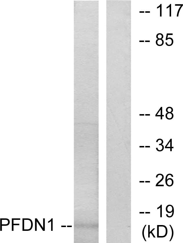 IHC-plus™ PFDN1 Antibody (aa1-50)
