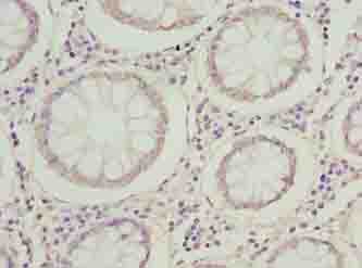 MRPL14 Antibody