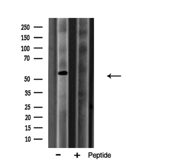 Polyclonal Rabbit anti-Human ARSA / Arylsulfatase A Antibody (IHC, IF, WB)