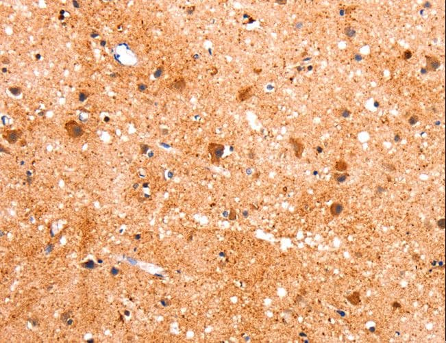 FABP7 / BLBP / MRG Antibody