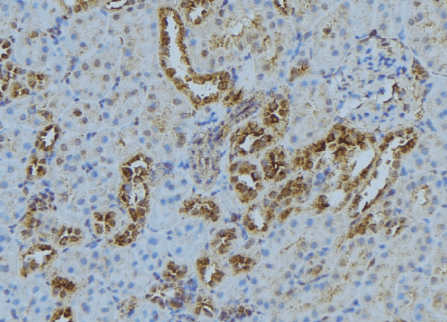 KIF3A Antibody