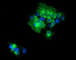 IHC-plus™ CD19 Antibody (clone 3G7)