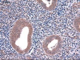 Monoclonal Mouse anti-Human EPCAM Antibody (clone OTI2C8, IHC, WB)