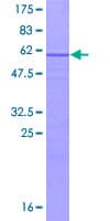 Human UTP11L Protein (Recombinant GST)