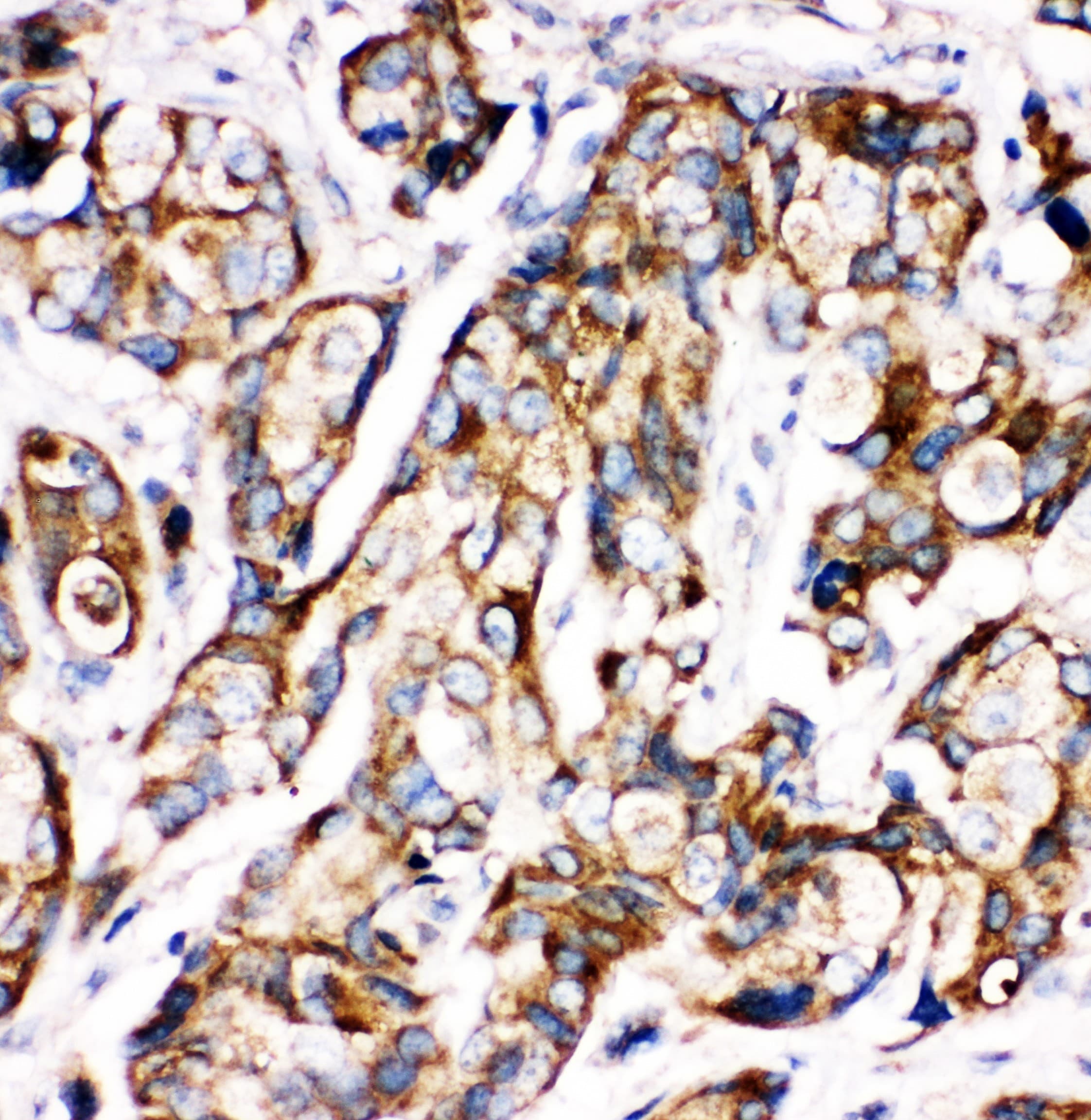 Polyclonal Rabbit anti-Human SHH / Sonic Hedgehog Antibody (aa203-218, IHC, WB)