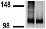 GABBR2 / GABA B Receptor 2 Antibody (clone S81-2)