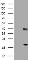 TS / Thymidylate Synthase Antibody (clone OTI1A3)