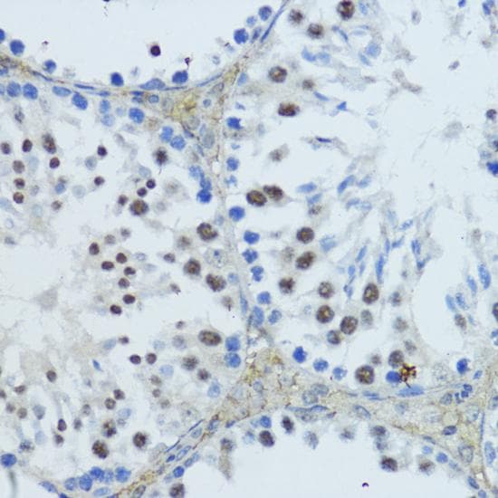 NR1I3 / CAR Antibody